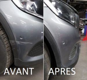 Baume carrosserie - Patchs Détox Pieds Exapatch